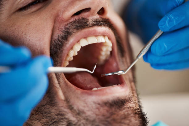 Best Full Mouth Reconstruction  in Thompson Falls, MT